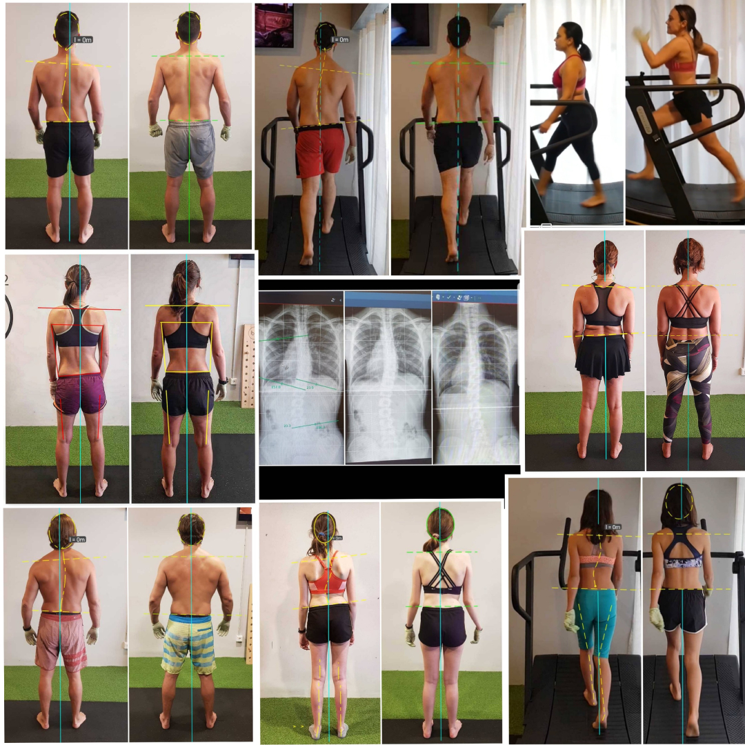 integra-estructuras-corporales-biomecanica